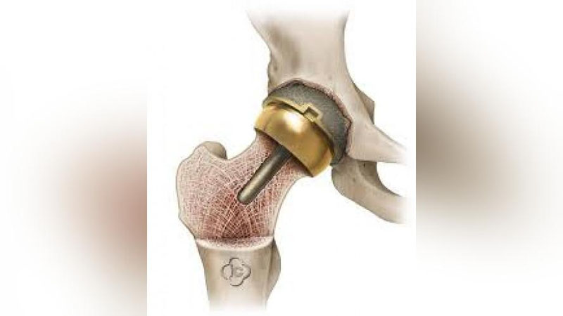 'СОХТА БЎҒИН ҚЎЙИШДА ИМТИЁЗЛАР БОРМИ?'ning rasmi