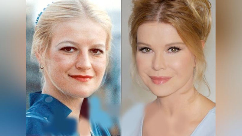 'Пластик операциялар “ишқибози”'ning rasmi