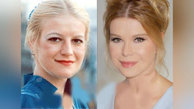 'Пластик  операциялар “ишқибози”'ning rasmi