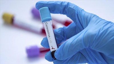 'Кеча Ўзбекистонда 370дан ортиқ кишида коронавирус аниқланди'ning rasmi