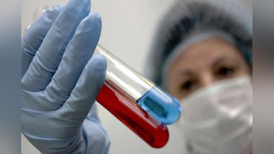 'ЎЗБЕКИСТОНДА ОИТС БИЛАН КАСАЛЛАНГАНЛАР СОНИ ҚАНЧАНИ ТАШКИЛ ЭТМОҚДА? 'ning rasmi