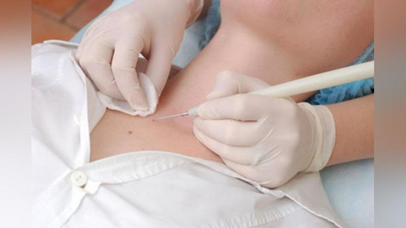 '“БЎЙНИМДА ТОШМА БОР...”'ning rasmi