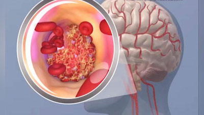 'INSULT BILAN OFRIGANLARNI HAYoTGA QAYTARAMIZ'ning rasmi