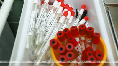 'COVID-19 нинг барча штаммларига қарши универсал вакцина яратиш учун антитанача топилди'ning rasmi