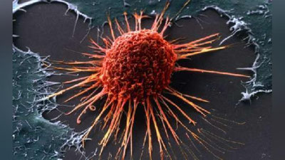 'Олимлар саратон келиб чиқишининг энг асосий сабабларини маълум қилишди'ning rasmi