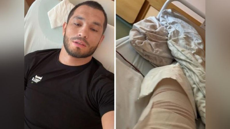 'Mahmud Muradov operasiya bo`ldi'ning rasmi