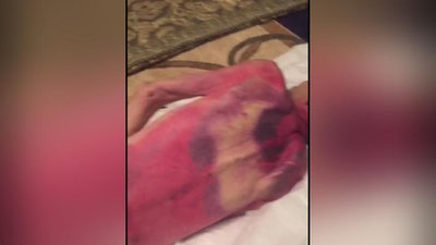 'Yana bir fuqaro qiynoqdan vafot etgani aytilmoqda'ning rasmi
