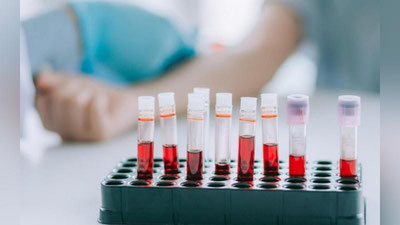 'Qon analizi nega topshiriladi?'ning rasmi