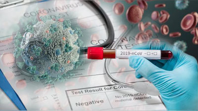 '6 noyabr soat 10:30 holatiga O`zbekistonda koronavirus infeksiyasi qayd etilganlar bo`yicha axborot berildi'ning rasmi