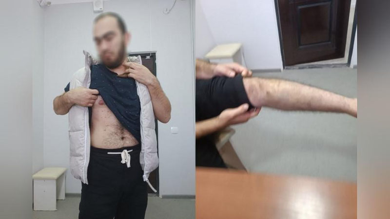 'Тошкент вилоятида божхона ходимлари гумонланувчини калтаклагани айтилмоқда'ning rasmi