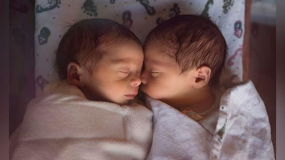 'O`zbekistonda bir sutkada 23 nafar egizak dunyoga keldi'ning rasmi