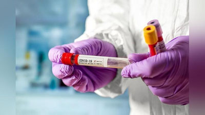 'Ўзбекистонда коронавирусдан касалланиш кўрсаткичи пасаймоқда'ning rasmi