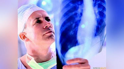 'Жаҳон соғлиқни сақлаш ташкилоти: Сил касаллигининг тарқалиши кутилганидан ҳам кўра тезлашиб бормоқда'ning rasmi