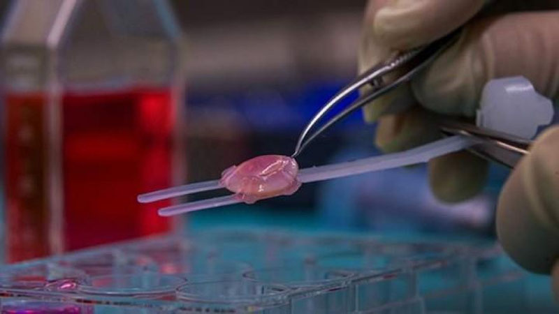 'O`zbekistonda ko`z to`r pardasini ko`chirib o`tkazish jarrohlik amaliyoti joriy etilishi mumkin'ning rasmi