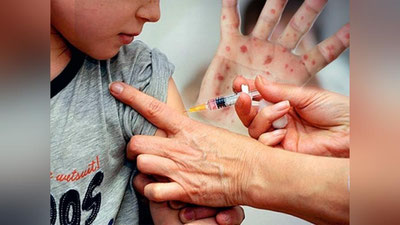 'YuNISEF: Uch yilda 48 million bola yuqumli kasalliklarga qarshi emlanmagan'ning rasmi