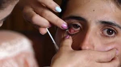 'Armanistonlik ayolning ko`z yoshlari kristallga aylanmoqda (Video)'ning rasmi