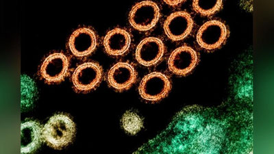 Изрображение 'ВОЗ переименует оспу обезьян ради устранения дискриминации африканцев'