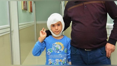 'O`ZBEKISTONDA ILK BOR KOXLEAR IMPLANTASIYa OPERASIYaSI O`TKAZILDI'ning rasmi