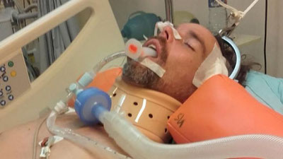 'БАЛИДА МАЙМУН ОРТИДАН ҚУВГАН САЙЁҲ ФАЛАЖ БЎЛИБ ҚОЛДИ'ning rasmi