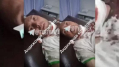 'Andijonda erkak tanishi tomonidan pichoqlangani haqidagi xabarga IIV izoh berdi (video)'ning rasmi
