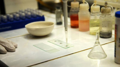 Изрображение 'Состояние 12-ти пациентов ташкентских клиник оценивается как тяжелое'