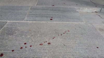 'Urgut tumanida maktab direktoriga og`ir jarohat etkazildi'ning rasmi