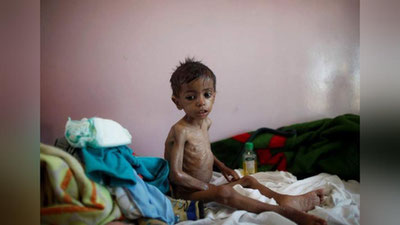 'Yamanda millionlab insonlar ochlikdan azob chekishmoqda'ning rasmi