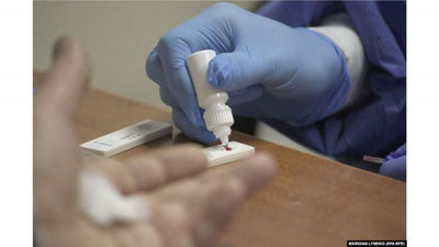 'Xitoyliklar yuborgan testlardan koronavirus yuqayotgani rostmi?'ning rasmi