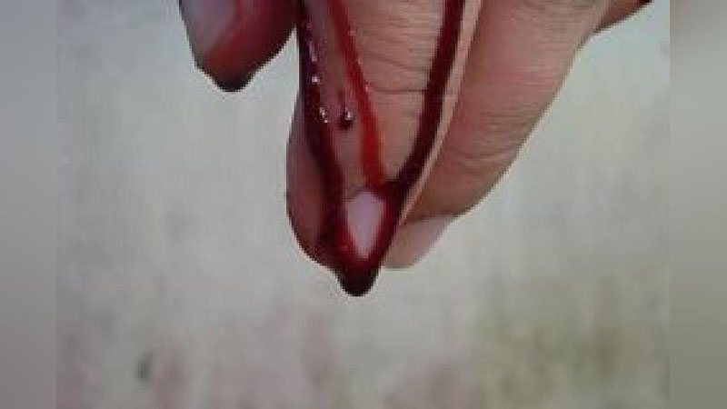 'Farg`onada kelinning boshini uzib, daraxtga ilib qo`ygan qaynotaga sud hukmi o`qildi'ning rasmi