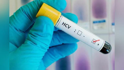 'ГЕПАТИТНИНГ АЛОМАТЛАРИ'ning rasmi