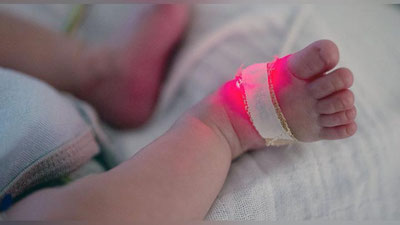 'Erini uyiga qaytarmoqchi bo`lgan ayol 9 oylik bolaning tanasiga ignalarni sanchgani ma`lum bo`ldi'ning rasmi