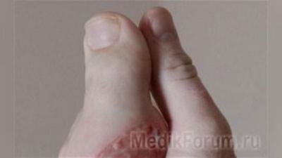 'АВСТРАЛИЯЛИК ЙИГИТНИНГ ОЁҚ БАРМОҒИ ҚЎЛИГА КЎЧИРИБ ЎТКАЗИЛДИ'ning rasmi