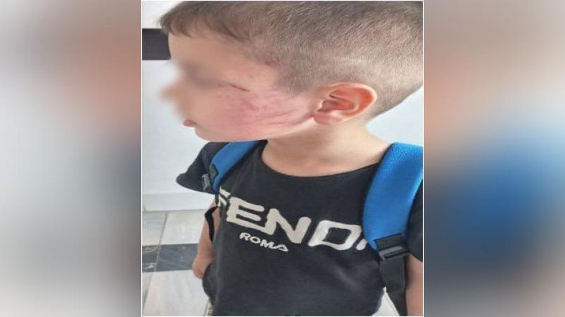 'Buxoroda erkak o`g`lini urgani uchun bog`cha bolasini kaltakladi'ning rasmi