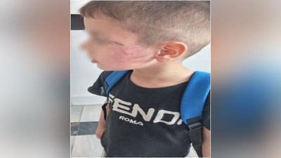 'Buxoroda erkak o`g`lini urgani uchun bog`cha bolasini kaltakladi'ning rasmi