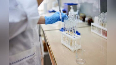 'Вазият жиддий:  бир кунда 600 дан ортиқ коронавирус билан касалланиш ҳолати қайд қилинди'ning rasmi