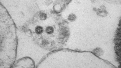 '"Omicrоn"нинг юзаларда яшаш қобилияти баҳоланди'ning rasmi