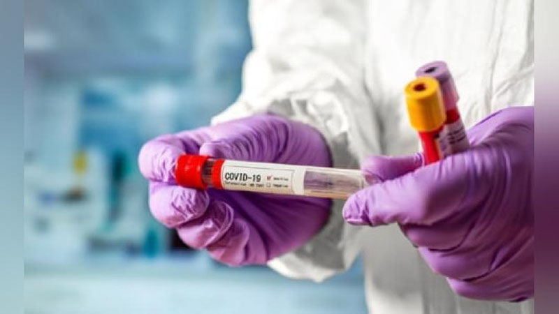 'Дунёда коронавирус билан боғлиқ ҳолат кескин ошмоқда'ning rasmi