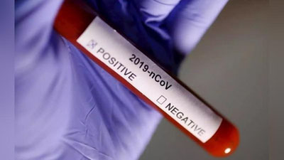 '​Коронавирус: юртимизда кетма-кет тўртинчи кун касалланишлар сони пасайди'ning rasmi