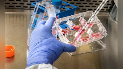 'Maymun chechagi aniqlangan mamlaktlar soni 103 taga etdi — JSST'ning rasmi