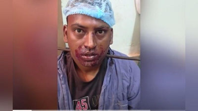 'Bo`yniga temir nayza kirib ketgan bemor o`z oyog`i bilan shifoxonaga keldi'ning rasmi