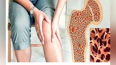 'Suyak emirilishini operasiyasiz davolash mumkinmi?'ning rasmi