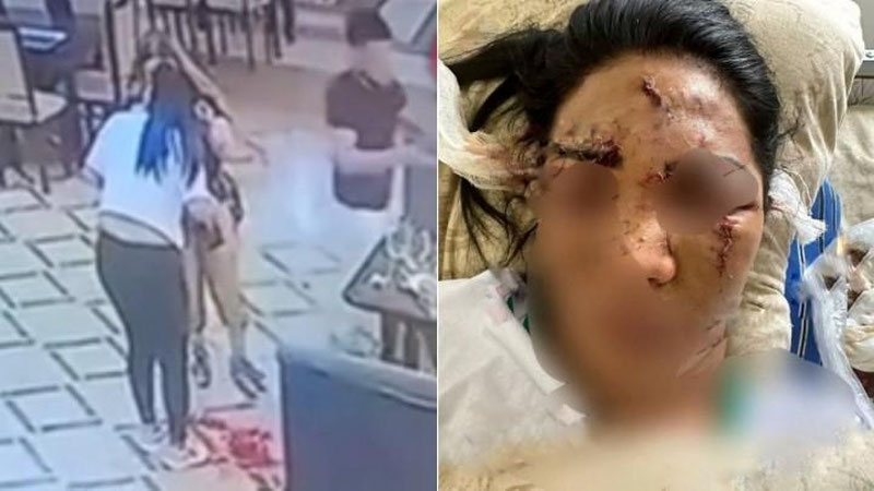 'Qashqadaryodagi kafeda ayolning yuziga "bokal" otib, jarohat etkazgan erkakka jinoyat ishi qo`zg`atildi'ning rasmi