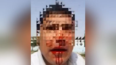 'Farg`onalik erkak o`z uyida do`pposlanib ketildi (video)'ning rasmi