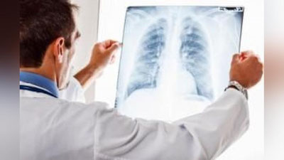 'Ҳаво ифлосланиши саратон касаллигининг ортишига олиб келиши мумкин'ning rasmi