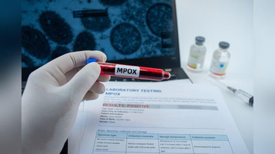 'ЖССТ: Дунёда маймун чечаги вируси яна фаоллашмоқда'ning rasmi