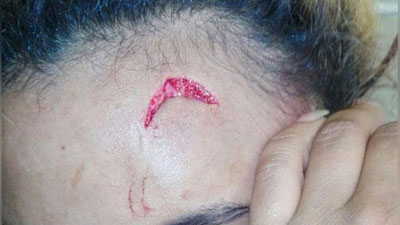 '​ЗИМБАБВЕНИНГ БИРИНЧИ ХОНИМИ ФОТОМОДЕЛНИ ЭЛЕКТР СИМИ БИЛАН КАЛТАКЛАДИ'ning rasmi