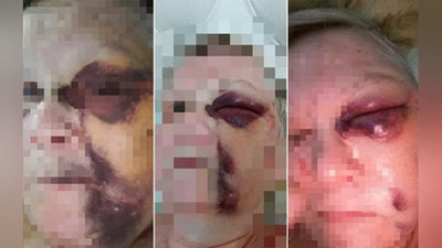 'Toshkentda 63 yoshli ayolga nevarasi tengi yigit shilqimlik qilgani aytilmoqda'ning rasmi