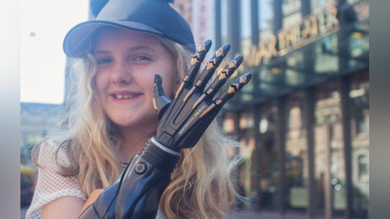 'BRITANIYaLIKLAR YaNGI PROTEZ IXTIRO QILIShDI'ning rasmi