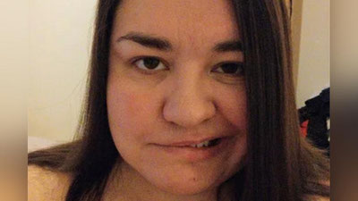 'Buyuk britaniyalik ayol zo`riqib ishlagani tufayli yuzi falajlanib qoldi 'ning rasmi