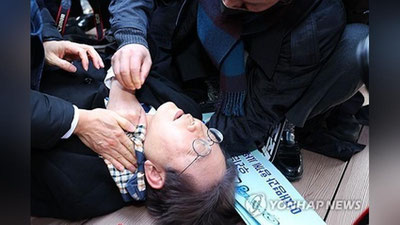 'Janubiy Koreyaning prezidentlikka nomzod Li Chjemyonga hujum qilishdi'ning rasmi